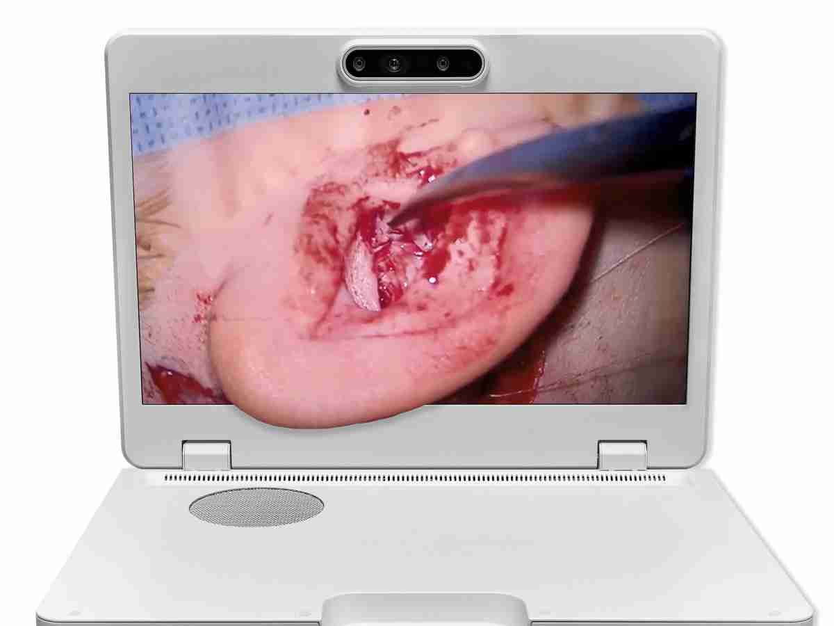 达擎之＂Heads-up 3D显微手术显示系统＂，，，，整合4K裸眼3D显示及眼球追踪系统，，，，具备快速追踪人眼移动位置功能，，，，减轻医师长时间维持固定姿势的负担，，让医师能有更宽广清晰的3D立体视野及更舒适的姿势来执行手术。。。